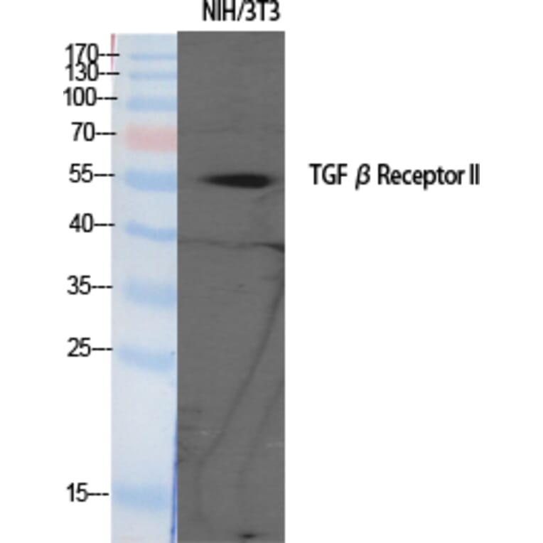 Western blot - TGFβ RII Polyclonal Antibody from Signalway Antibody (41492) - Antibodies.com