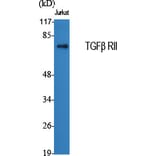 Western blot - TGFβ RII Polyclonal Antibody from Signalway Antibody (41493) - Antibodies.com