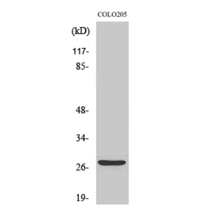 Western blot - TP53INP1 Polyclonal Antibody from Signalway Antibody (41507) - Antibodies.com