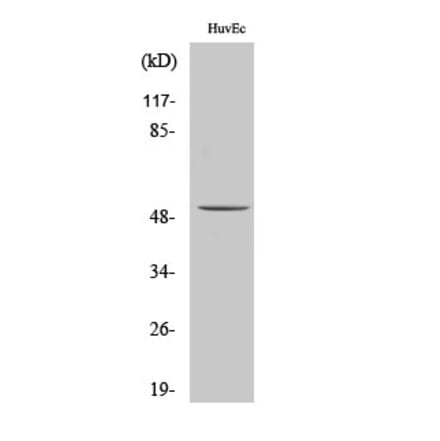 Western blot - ALDH3B1 Polyclonal Antibody from Signalway Antibody (40580) - Antibodies.com