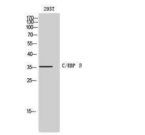 Western blot - C/EBP β Polyclonal Antibody from Signalway Antibody (40657) - Antibodies.com