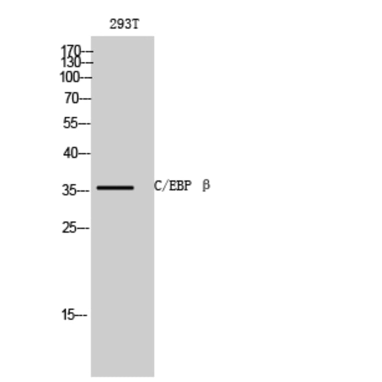 Western blot - C/EBP β Polyclonal Antibody from Signalway Antibody (40658) - Antibodies.com