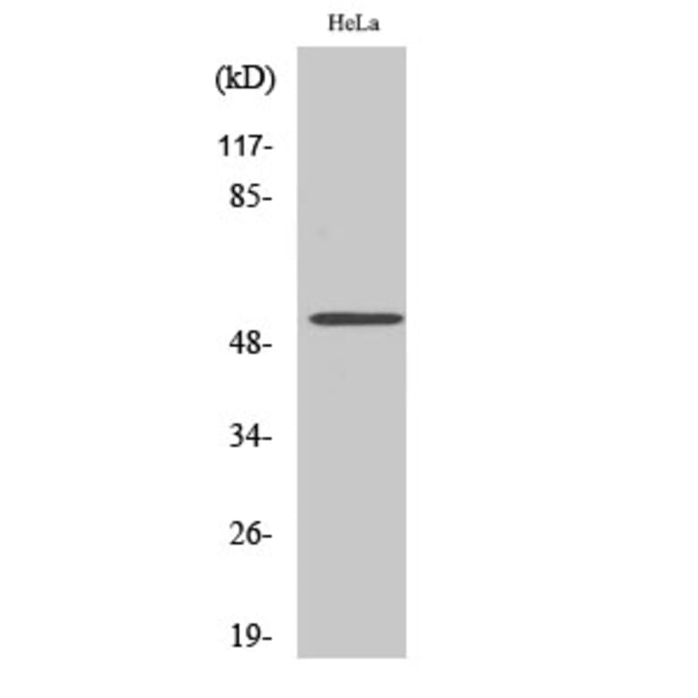 Western blot - CUG-BP1 Polyclonal Antibody from Signalway Antibody (40796) - Antibodies.com