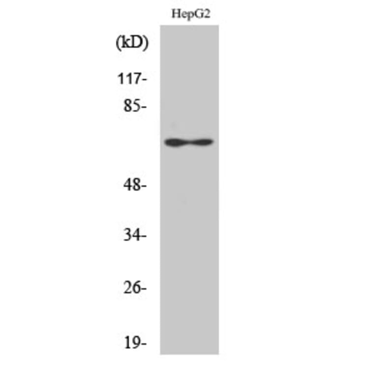 Western blot - Epsin 2 Polyclonal Antibody from Signalway Antibody (40896) - Antibodies.com