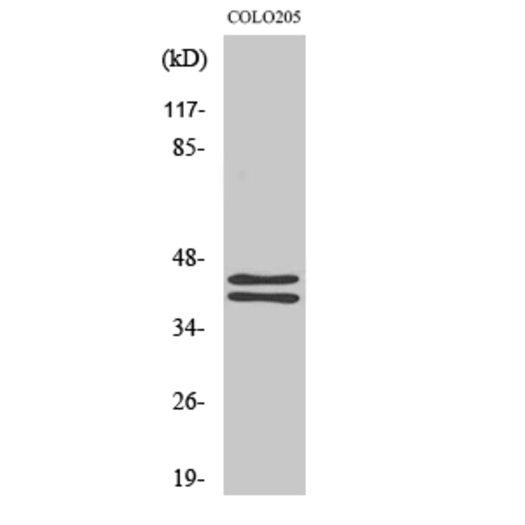 Western blot - ERK 1/2 Polyclonal Antibody from Signalway Antibody (40903) - Antibodies.com