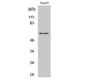 Western blot - hnRNP K Polyclonal Antibody from Signalway Antibody (41026) - Antibodies.com