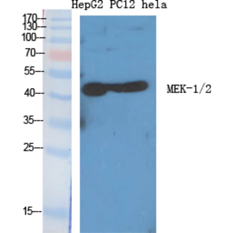 Western blot - MEK-1/2 Polyclonal Antibody from Signalway Antibody (41136) - Antibodies.com