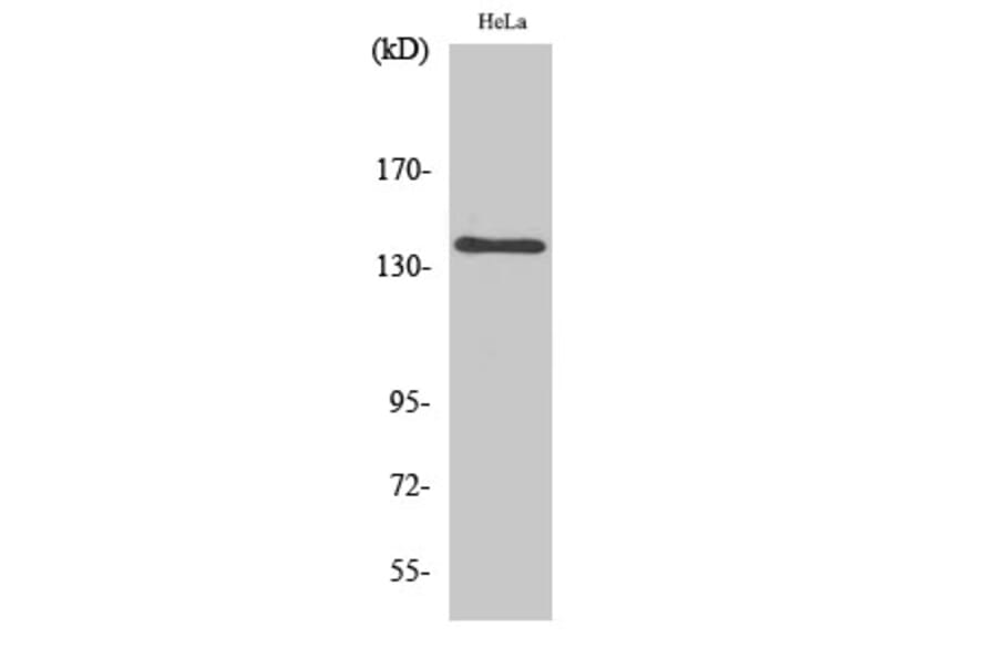 Western blot - MOV10L1 Polyclonal Antibody from Signalway Antibody (41163) - Antibodies.com