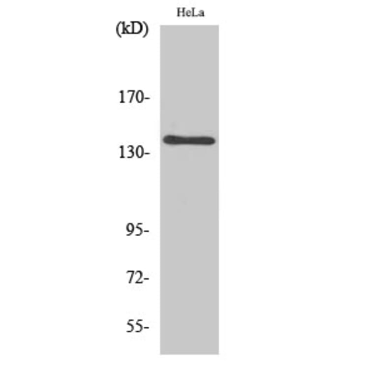 Western blot - MOV10L1 Polyclonal Antibody from Signalway Antibody (41163) - Antibodies.com