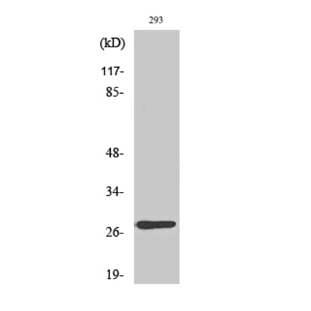 Western blot - MRP-L16 Polyclonal Antibody from Signalway Antibody (41171) - Antibodies.com