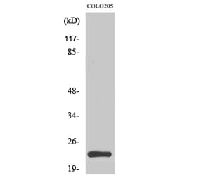 Western blot - MRP-L21 Polyclonal Antibody from Signalway Antibody (41173) - Antibodies.com