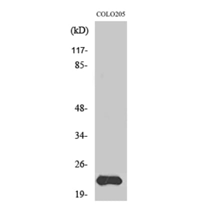 Western blot - MRP-L40 Polyclonal Antibody from Signalway Antibody (41176) - Antibodies.com