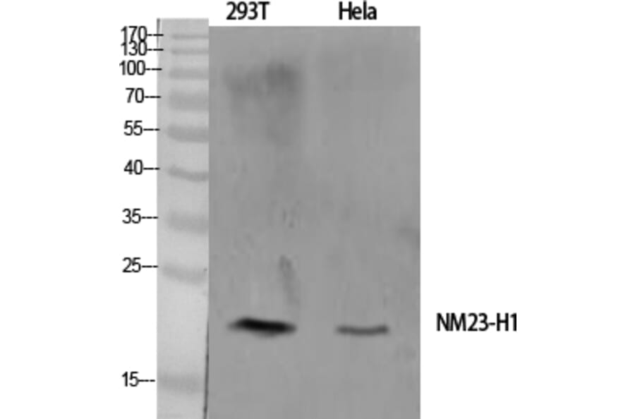 Western blot - NM23-H1 Polyclonal Antibody from Signalway Antibody (41245) - Antibodies.com