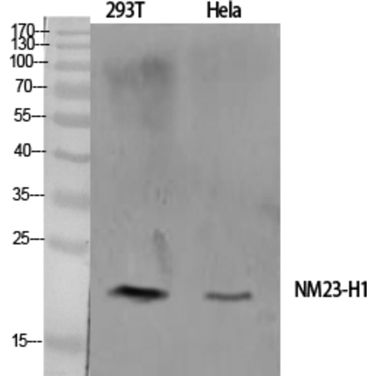 Western blot - NM23-H1 Polyclonal Antibody from Signalway Antibody (41245) - Antibodies.com