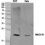 Western blot - NM23-H1 Polyclonal Antibody from Signalway Antibody (41245) - Antibodies.com