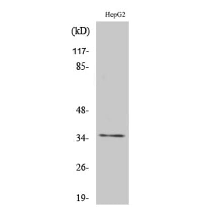 Western blot - Rag A/B Polyclonal Antibody from Signalway Antibody (41386) - Antibodies.com