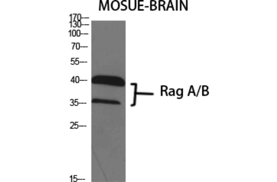 Western blot - Rag A/B Polyclonal Antibody from Signalway Antibody (41386) - Antibodies.com