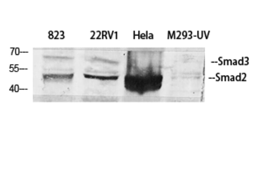 Western blot - Smad2/3 Polyclonal Antibody from Signalway Antibody (41444) - Antibodies.com