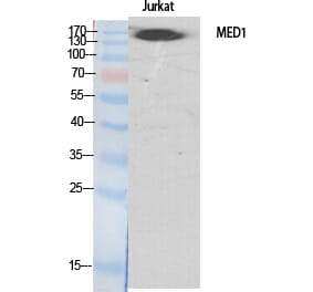 Western blot - TRAP220 Polyclonal Antibody from Signalway Antibody (41513) - Antibodies.com