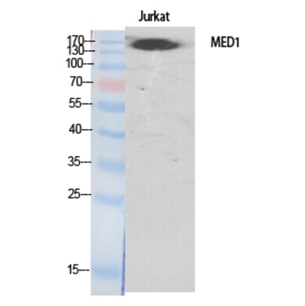Western blot - TRAP220 Polyclonal Antibody from Signalway Antibody (41513) - Antibodies.com