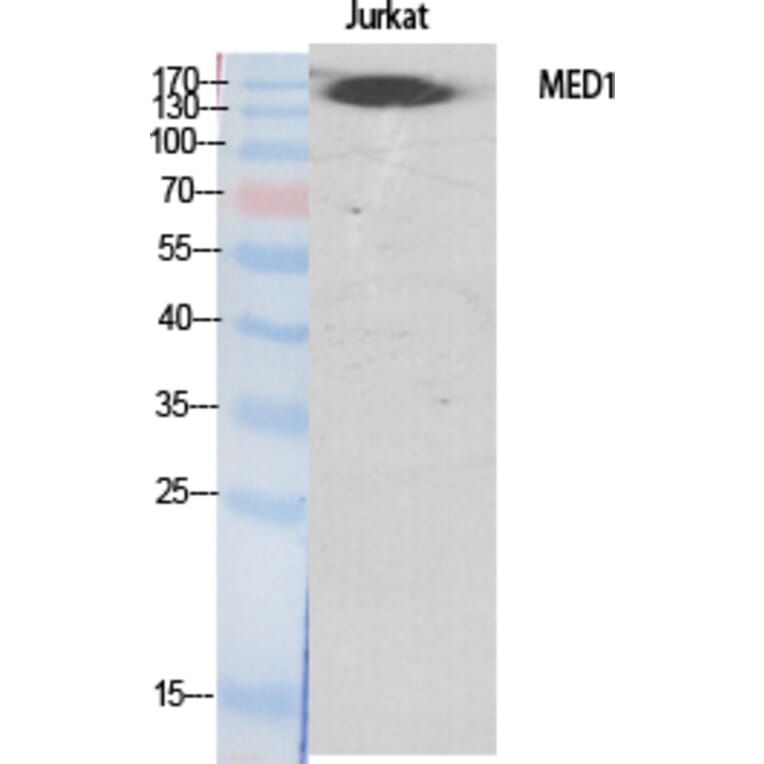 Western blot - TRAP220 Polyclonal Antibody from Signalway Antibody (41513) - Antibodies.com