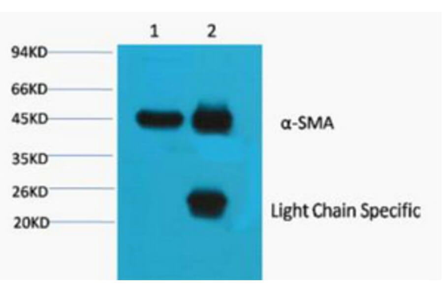 Cleaved-Plasma Kallikrein HC (R390) Polyclonal Antibody from Signalway Antibody (40521) - Antibodies.com