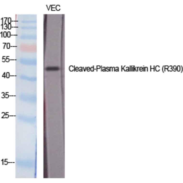 Western blot - Cleaved-Plasma Kallikrein HC (R390) Polyclonal Antibody from Signalway Antibody - Antibodies.com