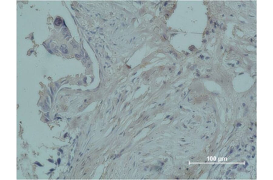 Immunohistochemistry - Cleaved-Plasma Kallikrein HC (R390) Polyclonal Antibody from Signalway Antibody (40521)