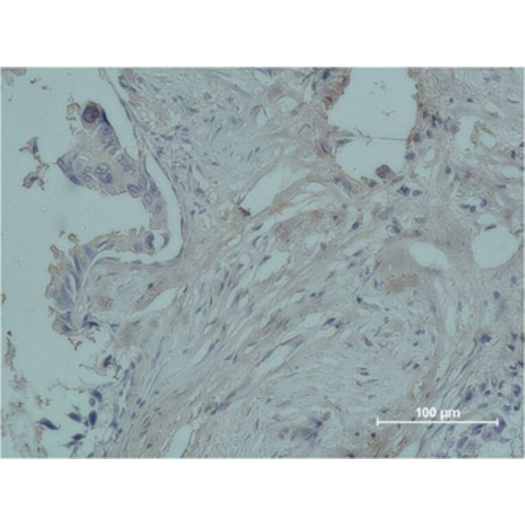 Immunohistochemistry - Cleaved-Plasma Kallikrein HC (R390) Polyclonal Antibody from Signalway Antibody (40521)