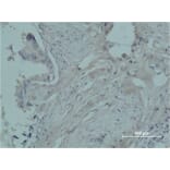 Immunohistochemistry - Cleaved-Plasma Kallikrein HC (R390) Polyclonal Antibody from Signalway Antibody (40521)