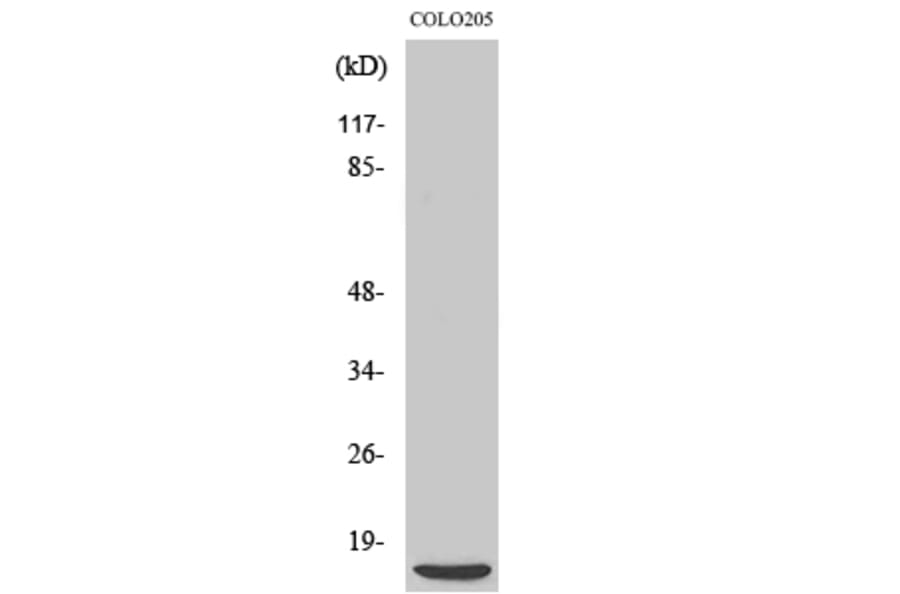 Western blot - 4E-BP1 Polyclonal Antibody from Signalway Antibody (40528) - Antibodies.com