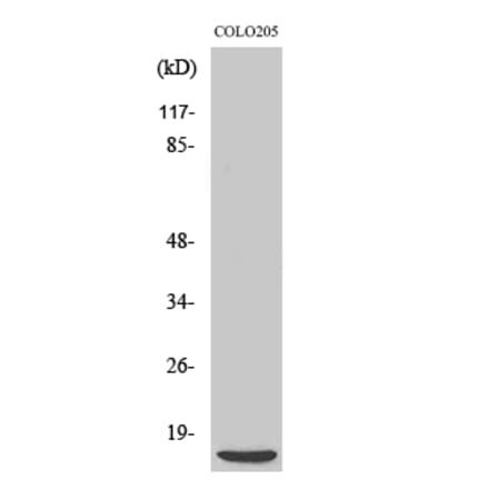 Western blot - 4E-BP1 Polyclonal Antibody from Signalway Antibody (40528) - Antibodies.com