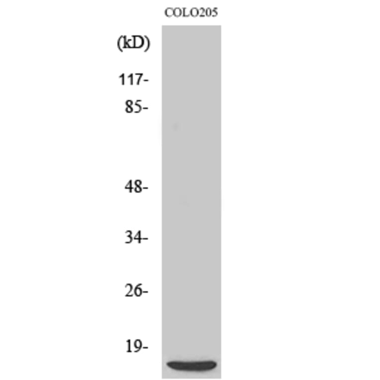 Western blot - 4E-BP1 Polyclonal Antibody from Signalway Antibody (40528) - Antibodies.com