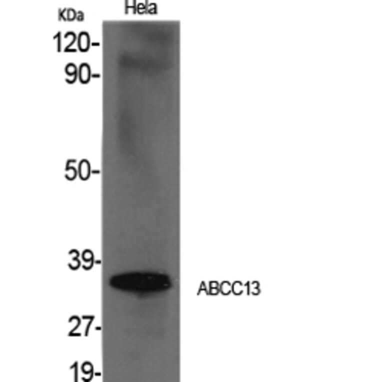 Western blot - ABCC13 Polyclonal Antibody from Signalway Antibody (40534) - Antibodies.com