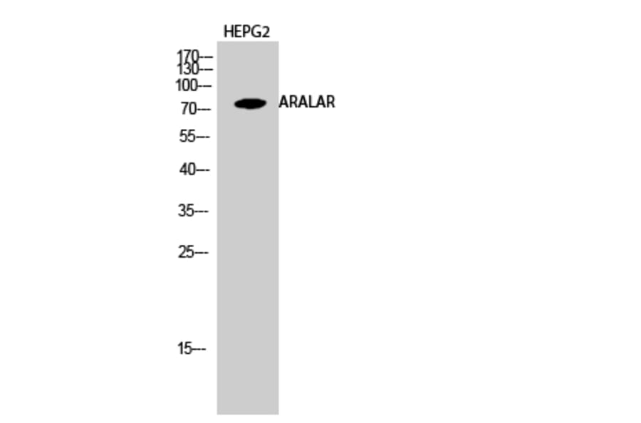 Western blot - ARALAR Polyclonal Antibody from Signalway Antibody (40611) - Antibodies.com