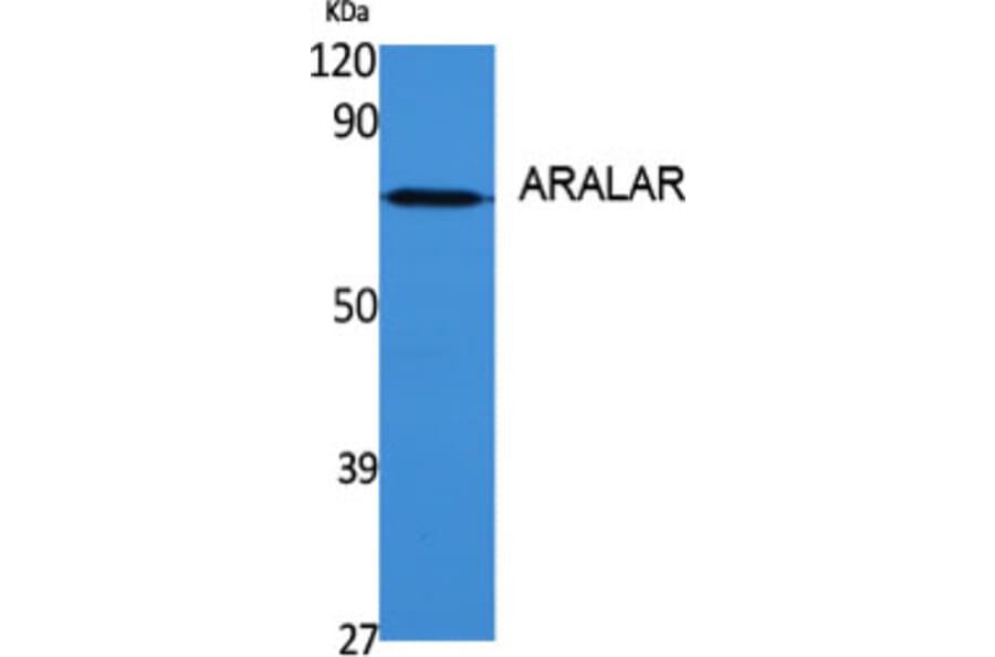Western blot - ARALAR Polyclonal Antibody from Signalway Antibody (40611) - Antibodies.com