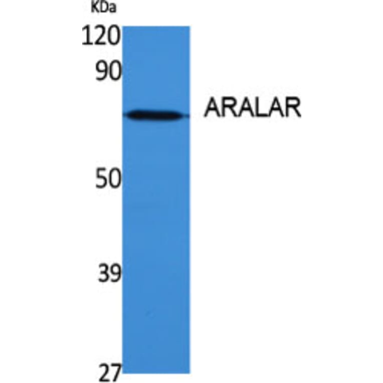 Western blot - ARALAR Polyclonal Antibody from Signalway Antibody (40611) - Antibodies.com