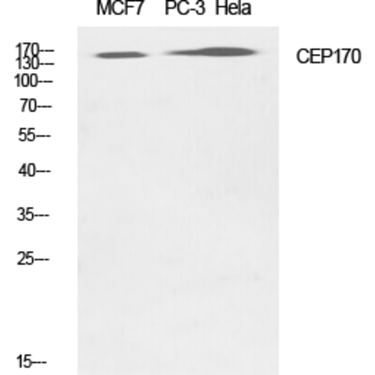 Western blot - CEP170 Polyclonal Antibody from Signalway Antibody (40727) - Antibodies.com