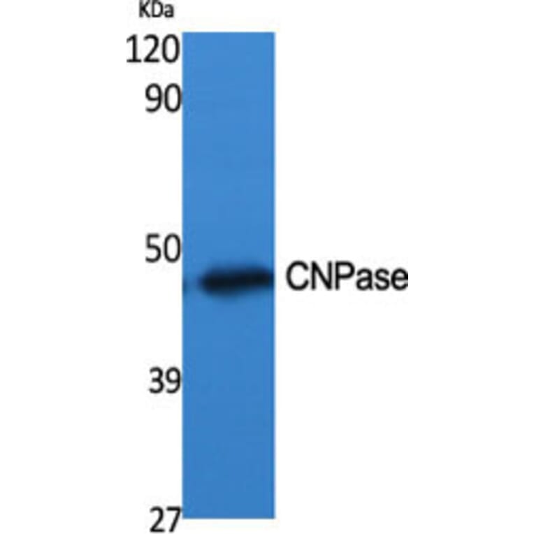 Western blot - CNPase Polyclonal Antibody from Signalway Antibody (40768) - Antibodies.com