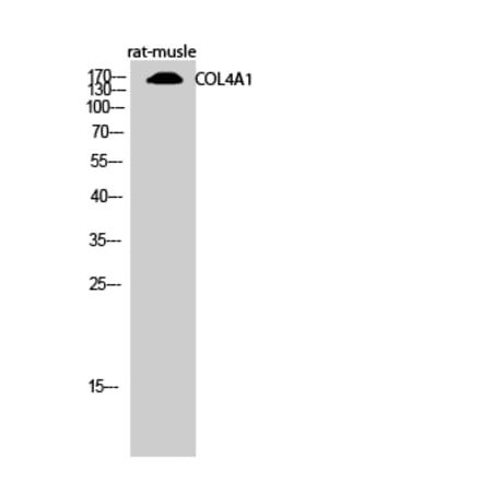 Western blot - COL4A1 Polyclonal Antibody from Signalway Antibody (40773) - Antibodies.com