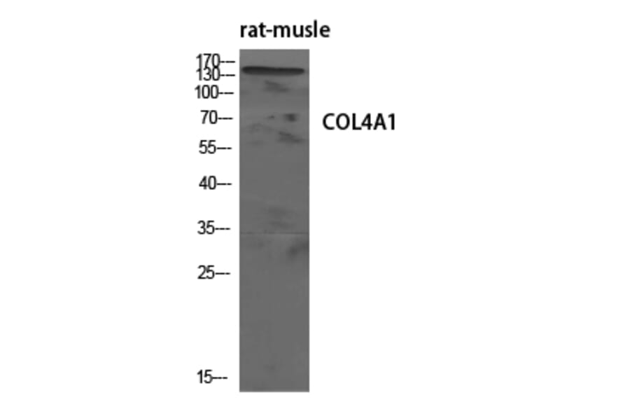 Western blot - COL4A1 Polyclonal Antibody from Signalway Antibody (40773) - Antibodies.com