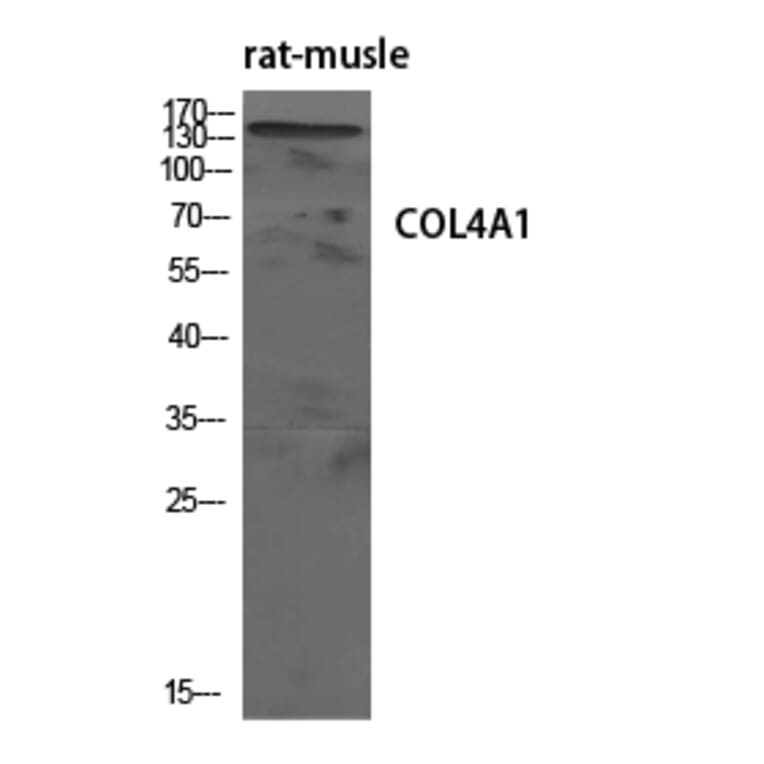 Western blot - COL4A1 Polyclonal Antibody from Signalway Antibody (40773) - Antibodies.com