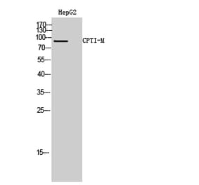 Western blot - CPTI-M Polyclonal Antibody from Signalway Antibody (40782) - Antibodies.com