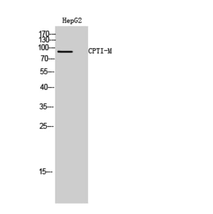 Western blot - CPTI-M Polyclonal Antibody from Signalway Antibody (40782) - Antibodies.com