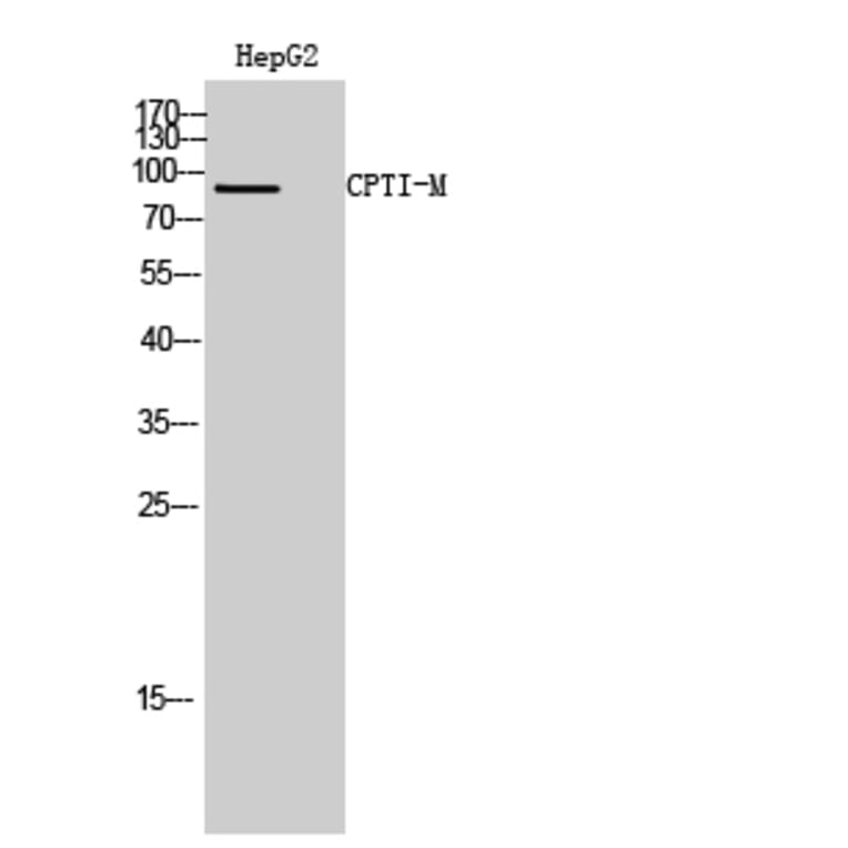 Western blot - CPTI-M Polyclonal Antibody from Signalway Antibody (40782) - Antibodies.com