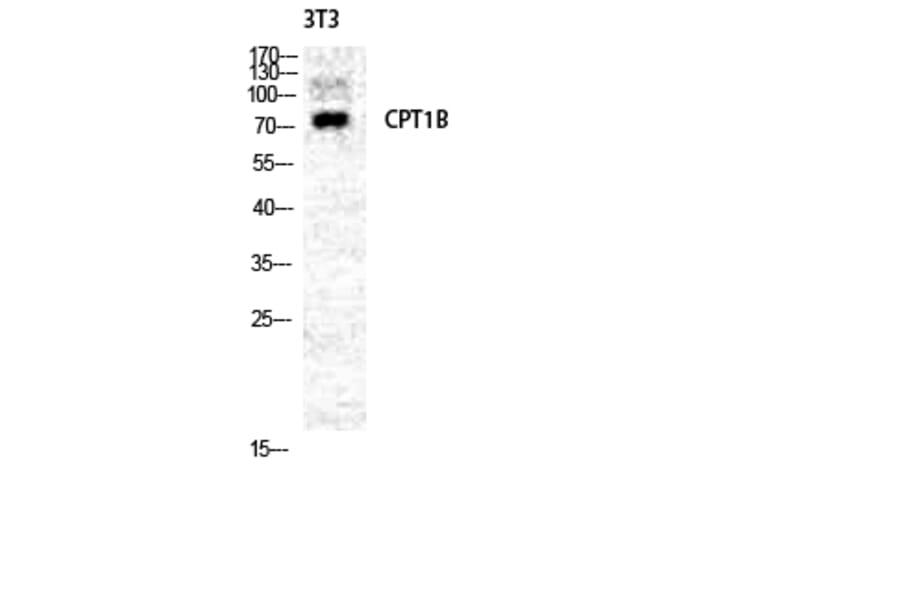Western blot - CPTI-M Polyclonal Antibody from Signalway Antibody (40782) - Antibodies.com