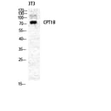 Western blot - CPTI-M Polyclonal Antibody from Signalway Antibody (40782) - Antibodies.com