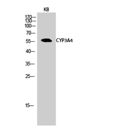 Western blot - CYP3A4 Polyclonal Antibody from Signalway Antibody (40817) - Antibodies.com