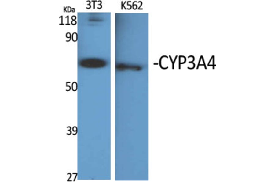 Western blot - CYP3A4 Polyclonal Antibody from Signalway Antibody (40817) - Antibodies.com