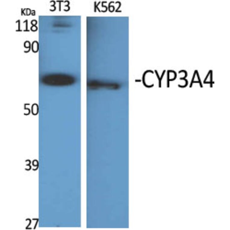 Western blot - CYP3A4 Polyclonal Antibody from Signalway Antibody (40817) - Antibodies.com